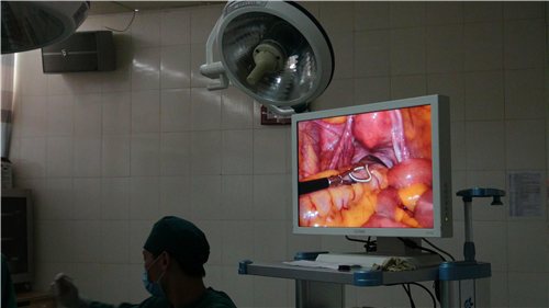 节育环还会过敏长到肉里面？到底该不该上环，看了以后真心疼女人！