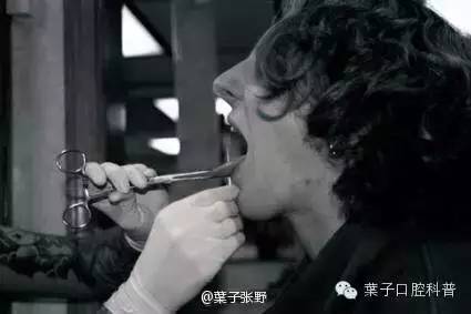 在牙科会感染艾滋病毒吗,在牙科弄牙齿会不会传染艾滋病