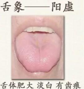 李铁红医生靠谱吗,舌头诊断疾病最简单的方法