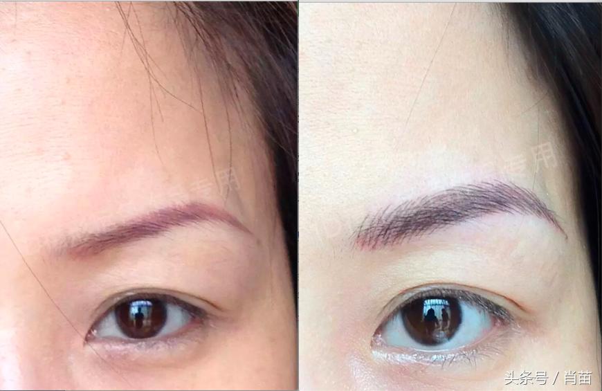 鑲栬嫍绾圭唬瑙嗛,鑲栬嫍鐪夊瀷璁捐