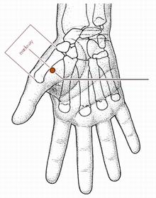 心烦失眠针灸,心烦针灸哪个穴位