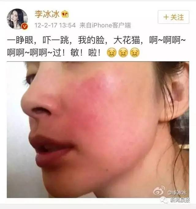 明星都逃不掉的事，健康Q博士说不定有办法