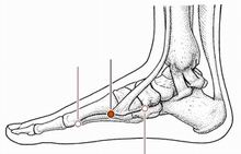 心烦失眠针灸,心烦针灸哪个穴位