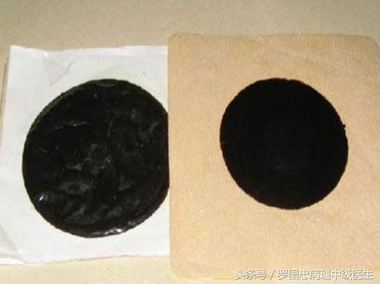 舒筋活络膏骨折可以用嘛,舒筋活络膏骨折