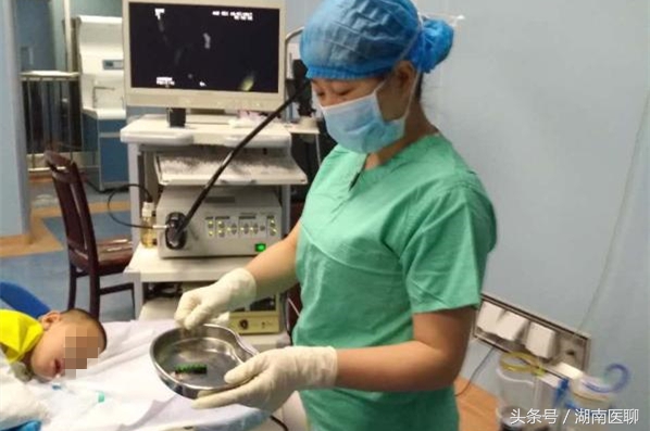 小孩胃溃疡出血好久恢复正常,十岁孩子胃粘膜糜烂