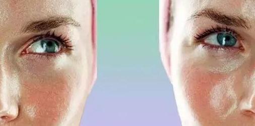 脸上摸起来硬硬的包但看不出来,脸上很多摸起来的痘痘