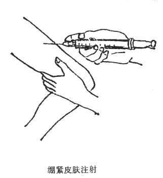 护士打针哪种握针方法更好,儿科护士打针技巧