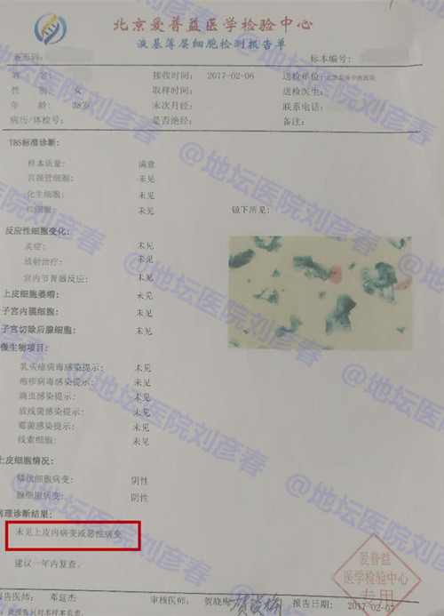 hpv病例分享,高危型hpv31阳性湿疣怎么治疗