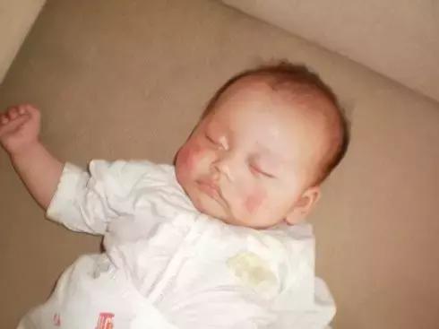 湿疹的宝宝如何度过夏天,夏天宝宝湿疹的应对方法