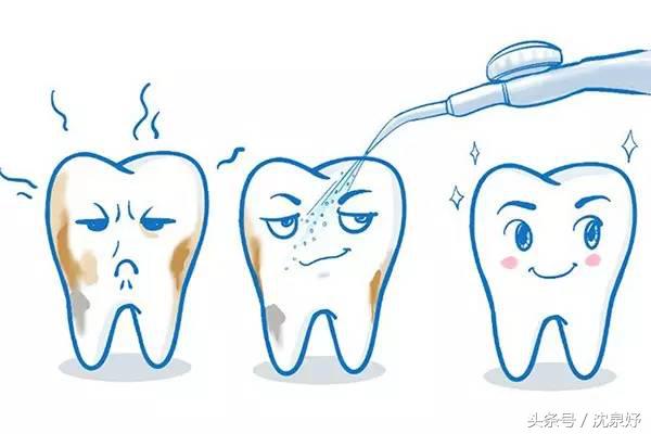 每天刷牙牙齿还黄？学会这些是美白牙齿的关键
