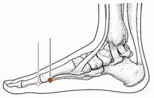 心烦失眠针灸,心烦针灸哪个穴位