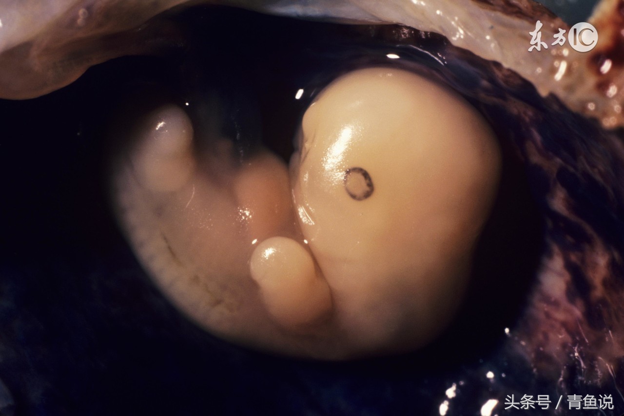 怀孕初期出血影响流产吗,早期怀孕出血10天胎儿能保住吗