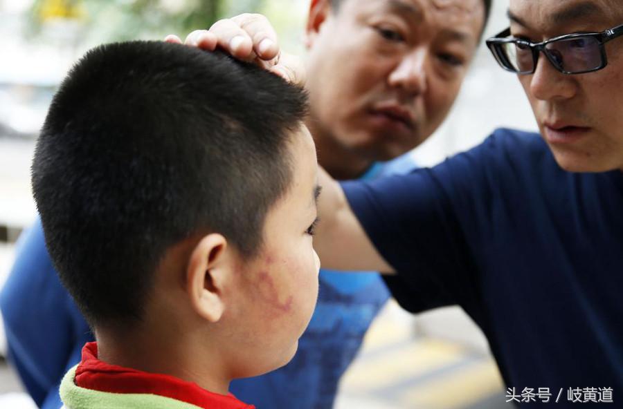 熊孩子被家长一巴掌打耳聋了？这可能不光是个意外！