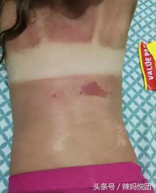 宝宝防晒霜使用不当会造成灼烧？烧烤模式般的天气下，宝宝防晒怎么选，防晒霜怎么用？