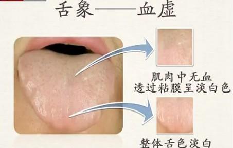 李铁红医生靠谱吗,舌头诊断疾病最简单的方法