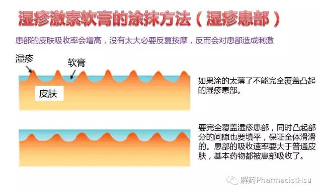 湿疹止痒最快的软膏新配方,湿疹保湿乳和药膏使用顺序