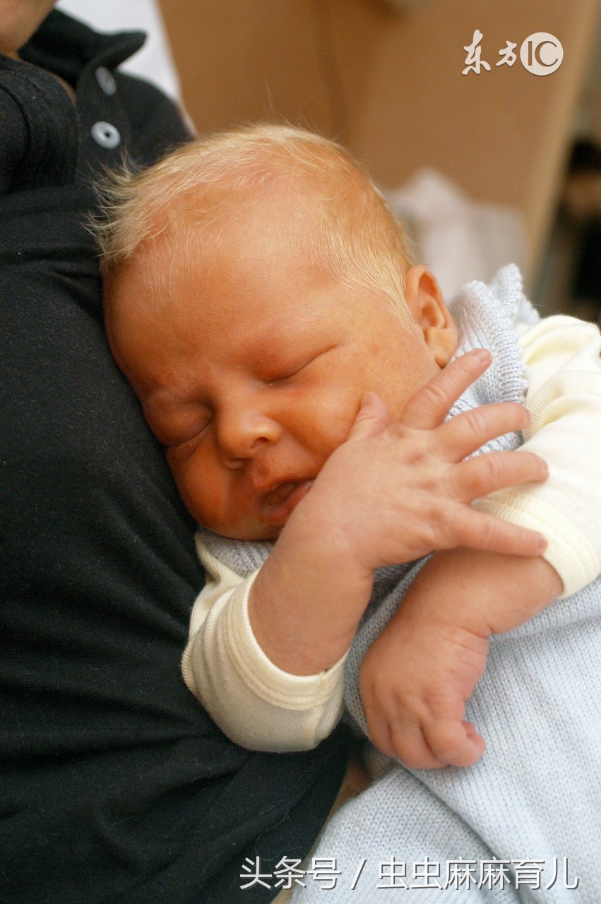 了解新生儿黄疸常见的原因,谈谈新生儿黄疸的护理知识