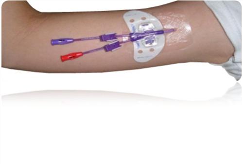 肿瘤患者都有picc吗,有picc的病人是有什么病