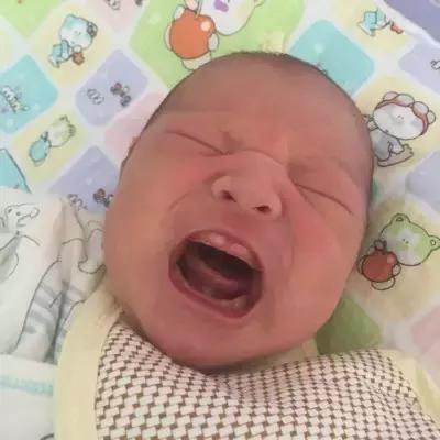 新生儿的六种异常状况,新生儿几大正常现象