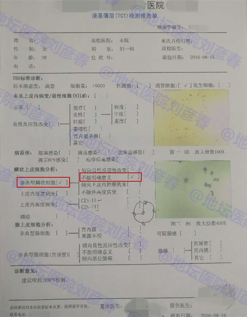 hpv病例分享,高危型hpv31阳性湿疣怎么治疗
