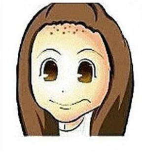 针对长在不同部位的痘痘，教你祛痘秘诀，还你18岁美丽肌肤！