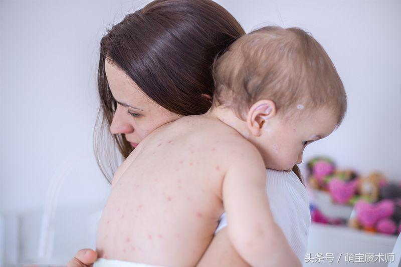 婴儿面部湿疹怎么护理效果最好,宝贝长湿疹怎么办