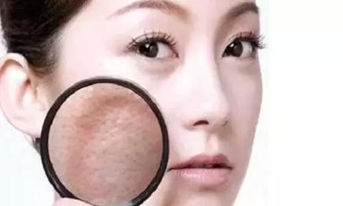 点阵激光可以解决皮肤老化吗,激光点阵和射频