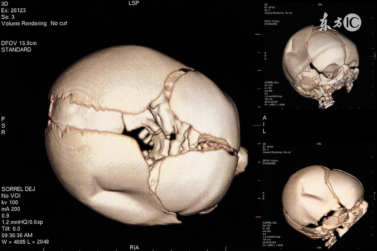 预产期怎么算才最正确简单方法,怎样能把预产期推后一点