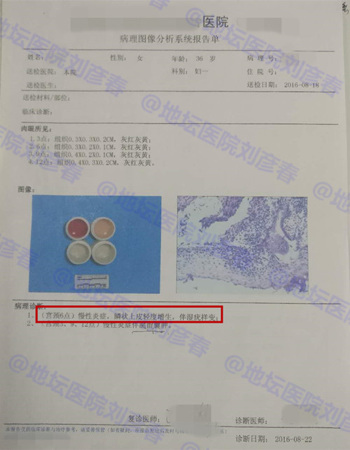 hpv病例分享,高危型hpv31阳性湿疣怎么治疗