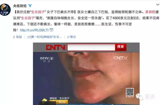 远离整形美容四大误区,手把手教你避开整形陷阱