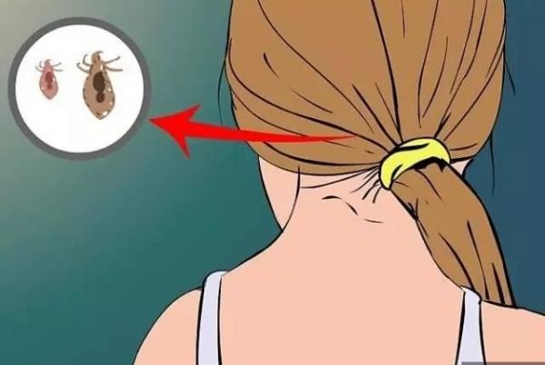 长头虱每天洗头效果好吗,女孩经常洗头怎么会长头虱