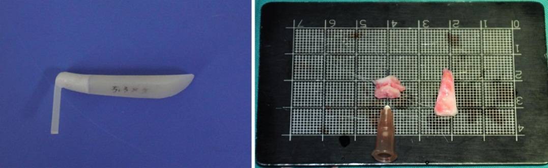 龅牙地包天怎么弄,龅牙怎么解决最好