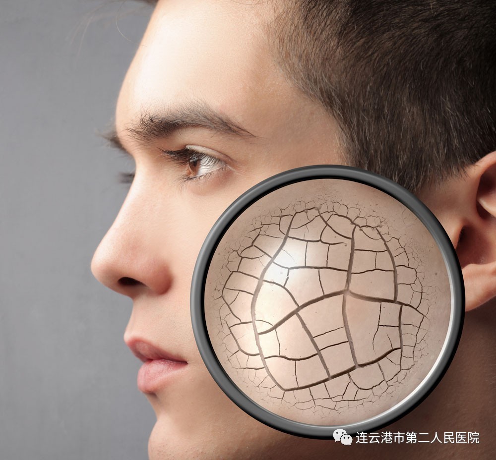 干燥综合症是免疫性疾病吗,干燥综合征是免疫性不孕吗