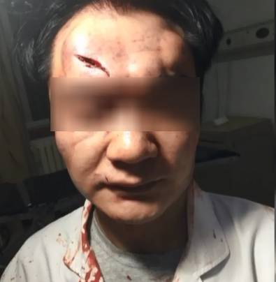 愤怒！安顺一医生被多名男子*力暴**围殴！头部遭踩踏、飞踹……监控记录全过程