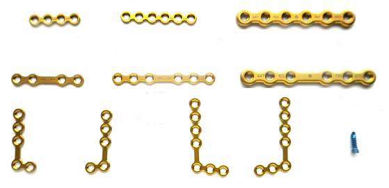 龅牙地包天怎么弄,龅牙怎么解决最好