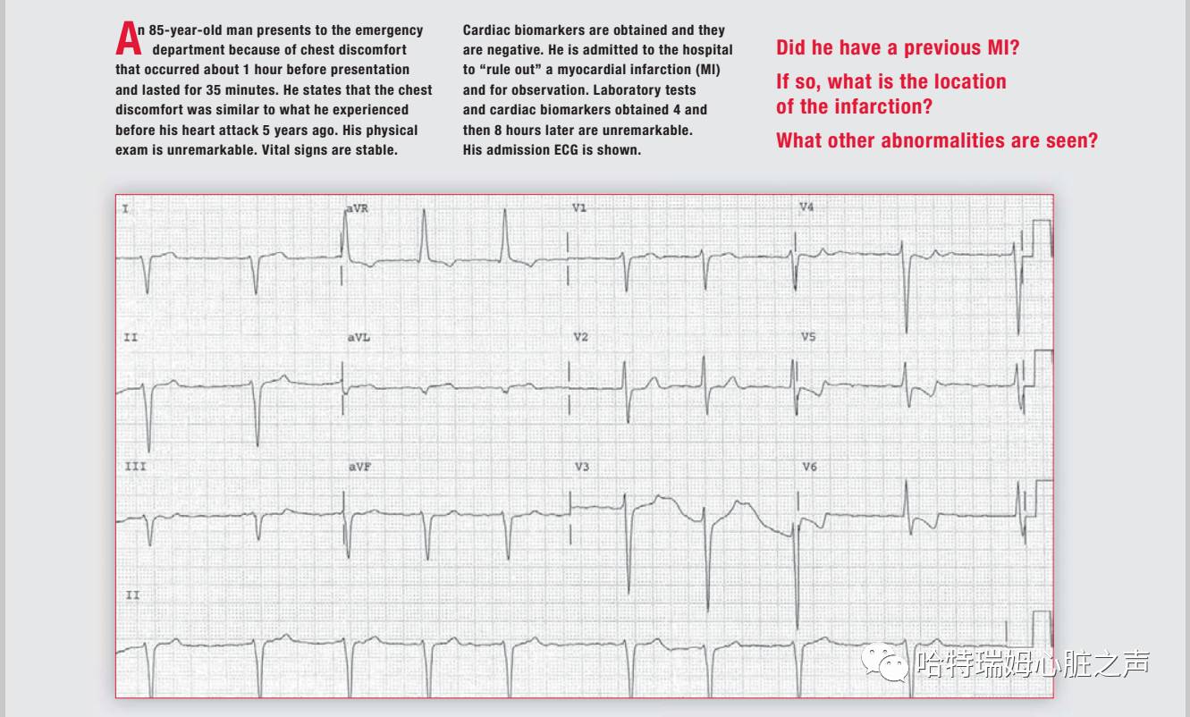 读心有术十二句话,读心有术2004