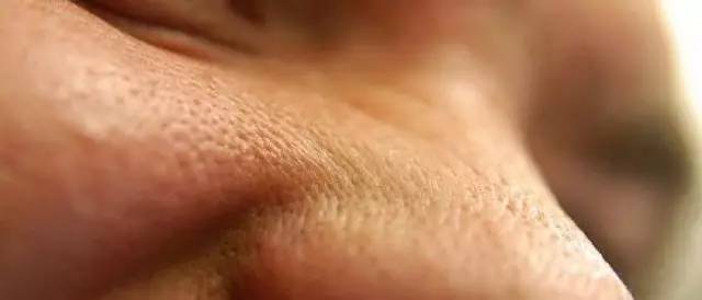 最全战痘攻略,战痘100种祛痘方法