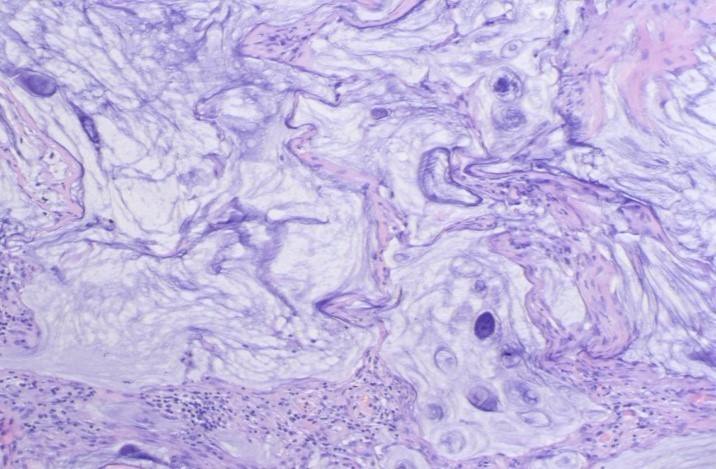 腹胀是怎么回事谨慎是这里生病了,腹胀是什么原因引起的胃不舒服