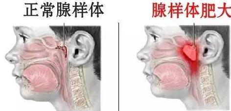 成都将迎高温暴雨,成都最近30度高温暴雨