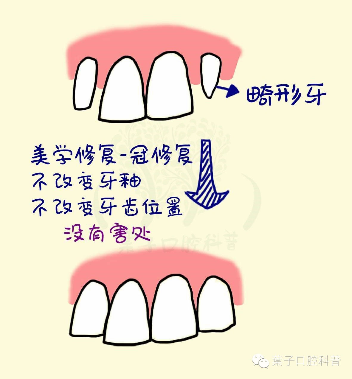 葉子口腔科普,口腔美容知识科普