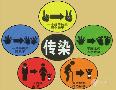 治疗灰指甲的药膏排行榜10强,斯皮仁诺治疗灰指甲的服用方法