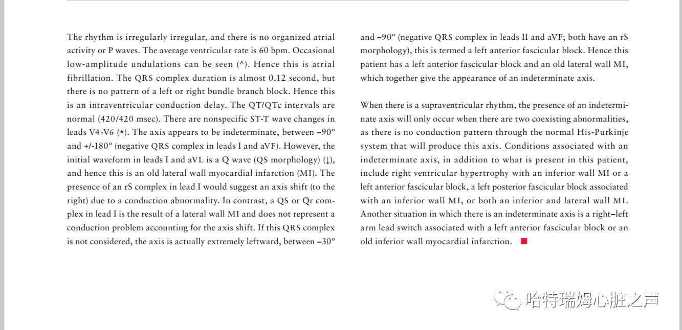 读心有术十二句话,读心有术2004