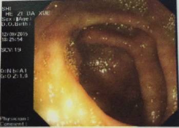 腹胀是怎么回事谨慎是这里生病了,腹胀是什么原因引起的胃不舒服