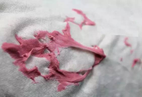 圆珠笔发黄了怎么办,白衣服被黑笔画下如何洗