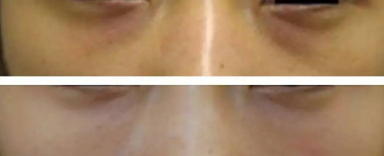 遮眼下黑眼圈细纹用什么遮瑕好,如何遮瑕遮掉黑眼圈细纹法令纹