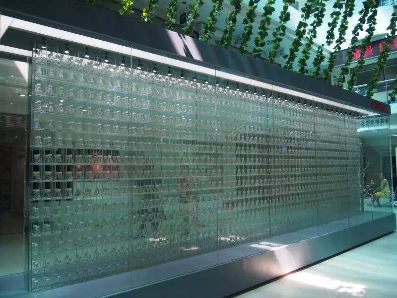 这个博物馆有点“疯狂”！2300份人体结石今天展出！就在东莞这个地方……