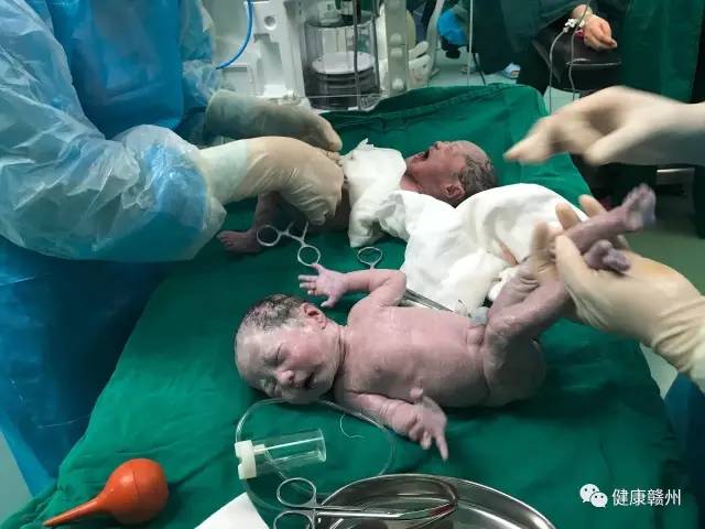 祝四胞胎心想事成,祝福双胎宝宝健康成长