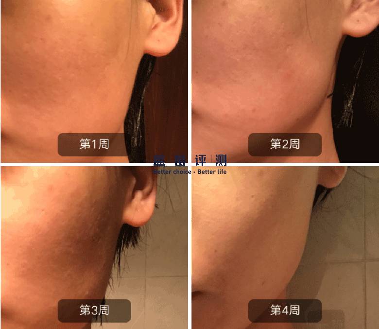 十大公认最好的美容仪,目前最好的美容仪是哪种