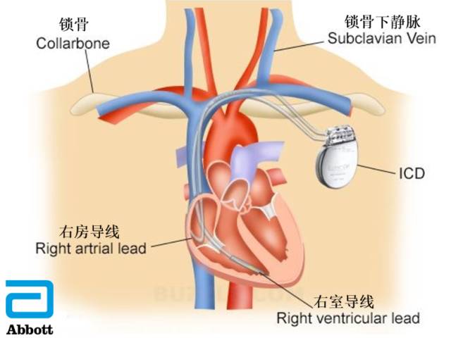 中国有多少人猝死,我国每年有多少人猝死