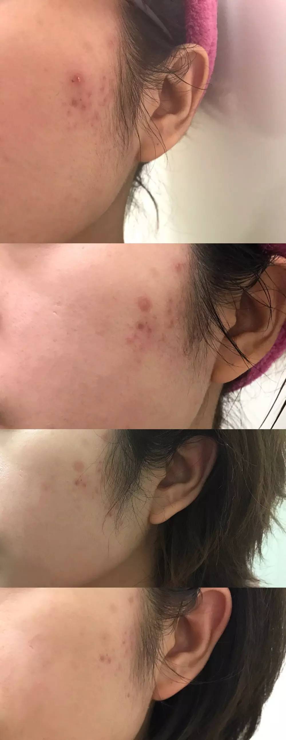 使用安全有效的护肤产品要看什么,使用报告